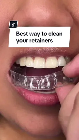 Best Way to clean your #retainers 🦷 #retainer #bracesoff #orthodontist #orthodontics #braces 
