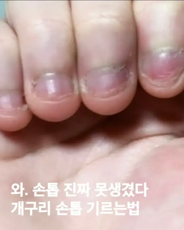 #못생긴손톱 #손톱기르기 