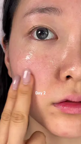 Enlarged pores? Time to add collagen to your routine. #torriden #koreanskincare #pores #poreminimizer #enlargedpores @TORRIDEN US 