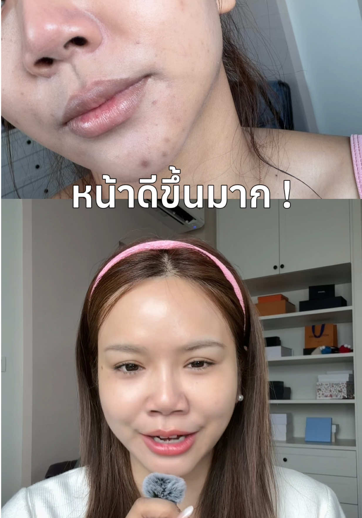 เข้าใจมาตลอด ว่าต้องเรตินอลแรง ถึงเห็นผล สรุปพัง ! 🥹 #ตึงนอลเซรั่ม #Nectapharma #รีวิวบิวตี้ #ช่องคุณซายน์ 