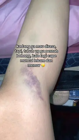 luka lebam ini lagi 🥹 #memar #lebam #maafkanaku #diriku 
