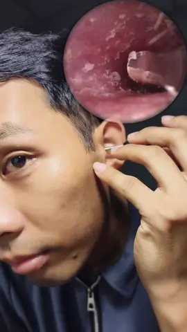 Thiết bị lấy ráy tai có camera nội soi quan sát rõ nét #dungcuthongminh7979 #layraytaicocamera #layraytainoisoi #layraitay 