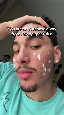 Wow #skin 