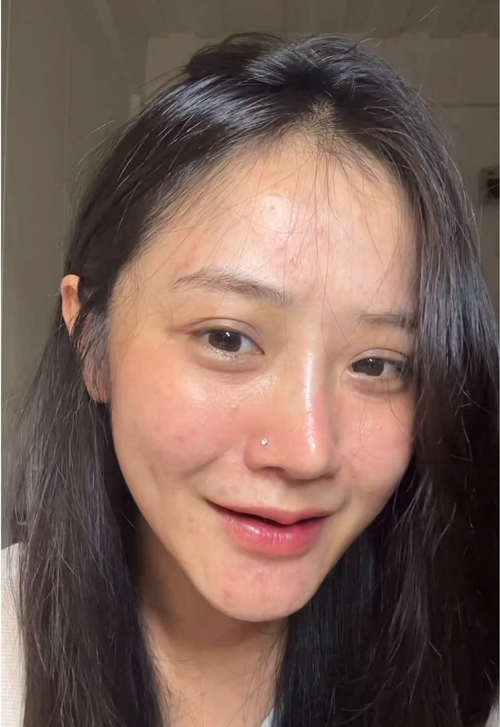 ทำไมเราพึ่งมาเจอกัน เป็นวิตามินที่ดีมากๆตัวนึงเลย 🥺🫶🏻 #วิตามินสวบสิว #Pearletane #Nectapharma #เนคตาฟาร์มา 