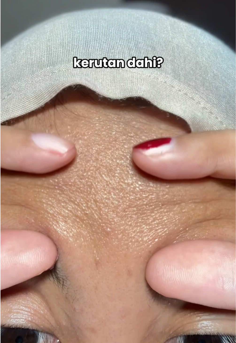 yang punya kerutan sekitar mata, atau didahi cuss pake retinol cream ini😍 #Retinol #AntiAging #zoicy