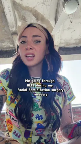 #trans #facialfeminization #transgender #transgirl #kasperjames 