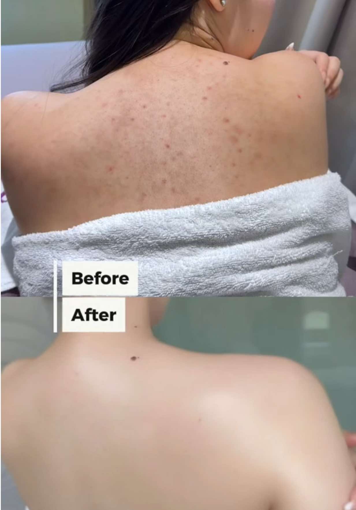Tự tin làn da ✨✨✨ #PaulasChoice #PaulasChoiceVietNam #AHAbody #HopTacCungPaulasChoice 