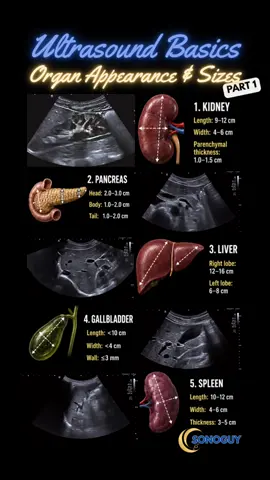 Before you can spot the abnormal you need to know the normal cold.  Organ appearance and reference sizes Part 1. The numbers every clinician and sonographer should have memorized. 📏 Kidney — 9-12 cm length, parenchymal thickness 1.0-1.5 cm 📏 Pancreas — Head ≤3 cm, Body and Tail ≤2 cm 📏 Liver — Right lobe 12-16 cm, Left lobe 6-8 cm 📏 Gallbladder — Length <10 cm, Wall ≤3 mm 📏 Spleen — Length 10-12 cm Save this. Reference it every time you scan. 👇 Part 2 coming soon. 🔒 #sonocrew #ultrasound 