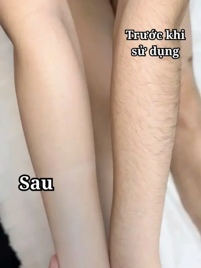 toi yeu dreyem quá điiiiii #DrEyemo#hairremoval #kemtaylong #taylong #xuhuong