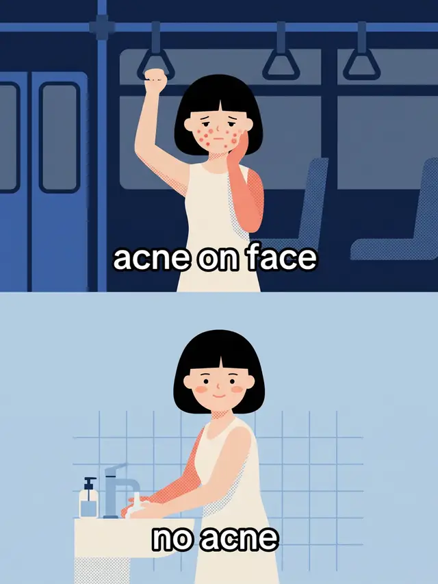 sometimes simple beats complicated 🥰 #acneprone #baselit #skincaretips