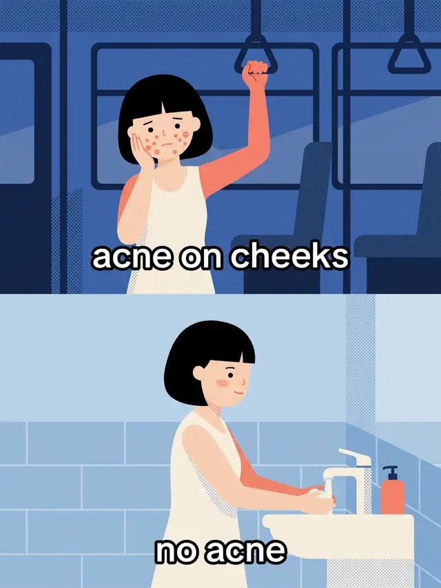 tag a friend who always has a hand on her face 🫵 #baselit #skinbarrier #glassskin
