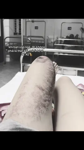 #xuhuong #fyp #viral 