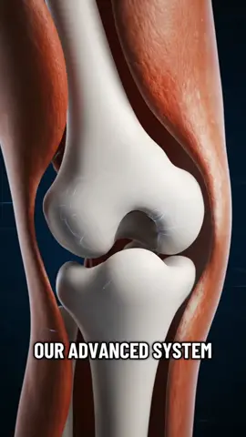 The Knee Replacement Process Is WILDER Than You Think! 🦵🤯 #KneeReplacement #KneeSurgery #MedicalAnimation #SurgeryExplained #MedicalTok #AnatomyTok #MedicalFacts #HealthEducation #OrthopedicSurgery #HumanBody #ScienceTok #DidYouKnow #USA #LearnOnTikTok #FYP