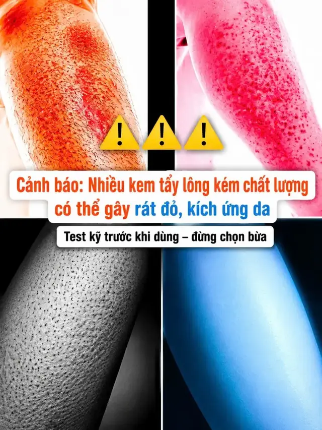 Top các cách tẩy lông được nhiều người lựa chọn#DrEyemo#hairremoval #kemtaylong #taylong #xuhuong