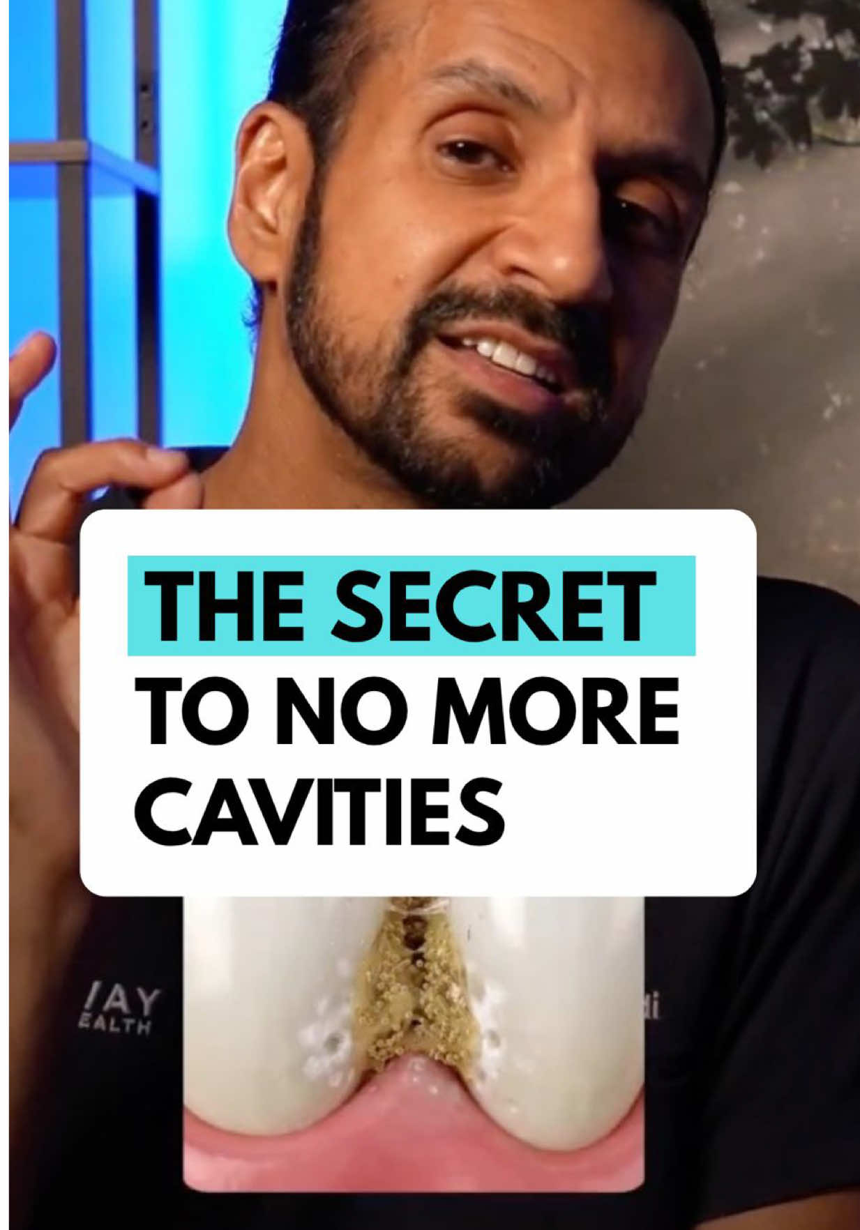 The cavity pattern your dentist misses. #teeth #dentalcare #mouth #healthhacks #saliva 