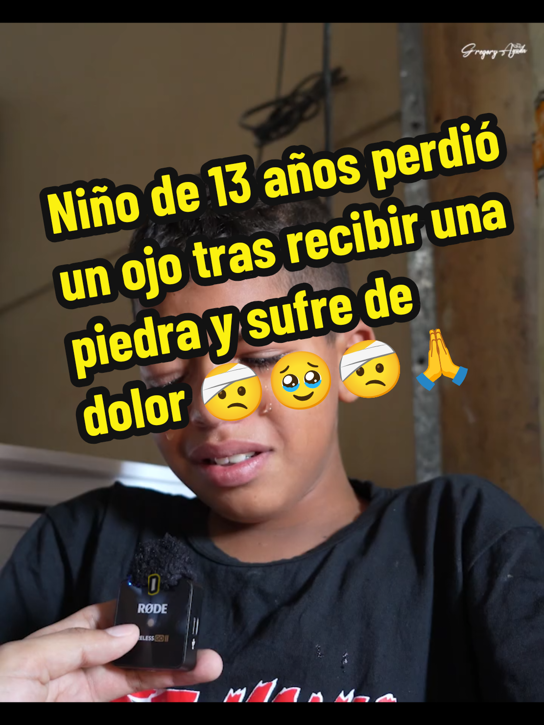 niño de 13 años perdió un ojo tras recibir una piedra y sufre de dolor 🤕 #monetizartiktok #tiktokviral #fypシ゚viral🖤tiktok #reflexion #lasaventurasdeloriginal 
