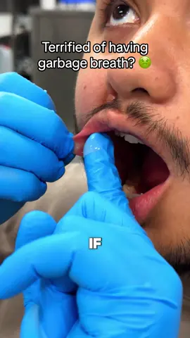 Is this you? 😳 #mouthwash #ad 