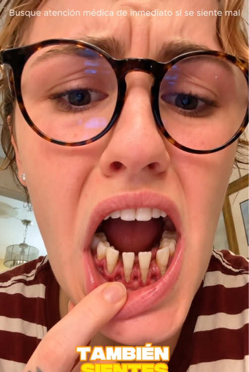 “Are your gums slowly pulling away from your teeth?” Receding gums can be a sign that your oral health needs attention.#amicoral #oral #gumrecession #tooth #mouthwash 