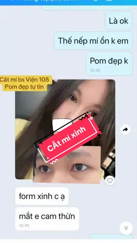 Cắt mí xinh đẹp bs Viện 108 #xuhuong #benhvien108 #bscanh108 #cắtmi #pttm 