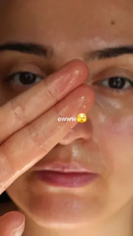 @FULLY Skincare  A total game-changer for clear skin—it melts away blackheads gently with AHA, LHA, and peptides without irritating sensitive skin! 🌿 #CreamToOil #SebumControl #FullySkincare #Fully #fyp 