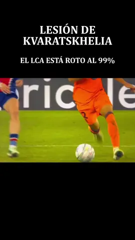🚨 ÚLTIMA HORA | PSG vs FC Barcelona ⚠️ Preocupación por Khvicha Kvaratskhelia. Por el mecanismo de lesión y lo que podemos observar en las imágenes, existe una sospecha de lesión del ligamento cruzado anterior (LCA). Aun así, esto es solo una valoración preliminar. Será necesario realizar una exploración clínica y una resonancia magnética para confirmar el diagnóstico. Ojalá no sea nada grave y Kvaratskhelia pueda volver pronto. 🙏