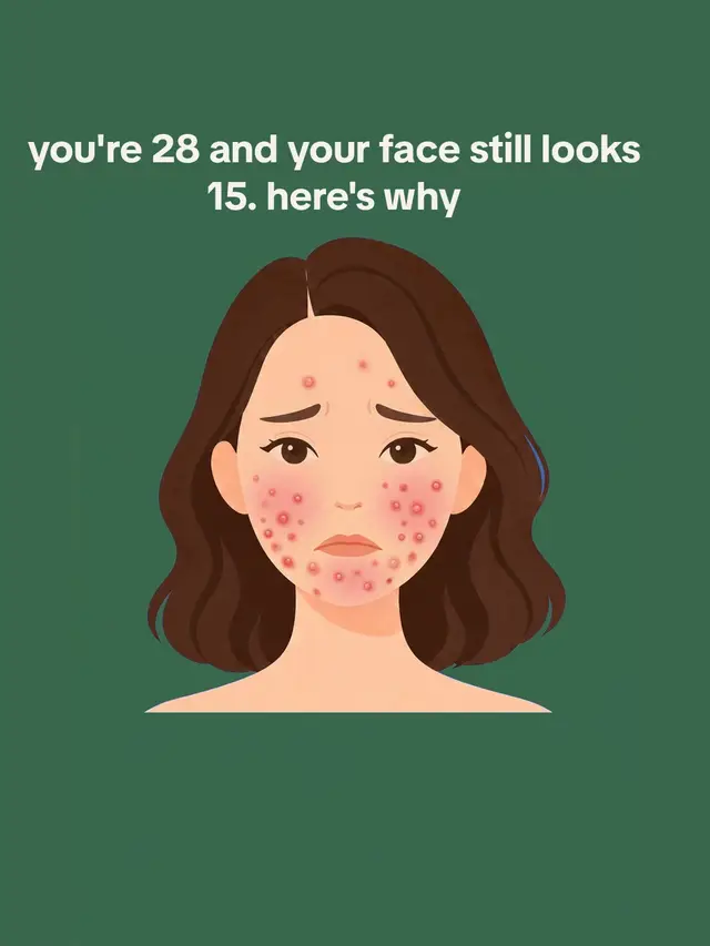 the habits behind your spots ✨ #baselit #skincare #acne #clearskin