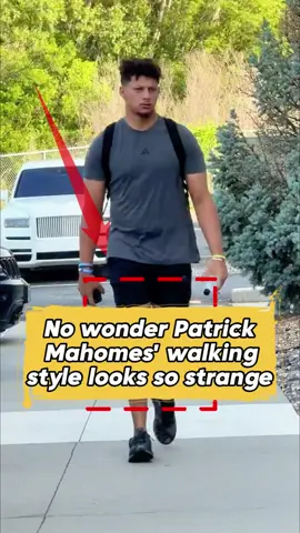 No wonder Patrick Mahomes’walking style looks so strange #TikTokCampaign #football #nfl #nflfootball #patrickmahomes 