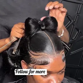 Frontal install 