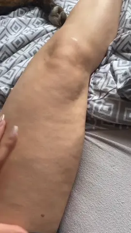 Smoother-looking skin starts with the right routine ✨ #massage #routine #smoother #cellulite #legs 