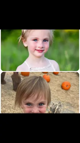 I posted awhile back regarding my daughter‘s hair being so thin and not growing. I started her on children’s biotin Gummies twice a day and so far these are the results. Top picture is six months ago. I see a huge improvement. #biotin #hairgrowth #MomsofTikTok #youngest 