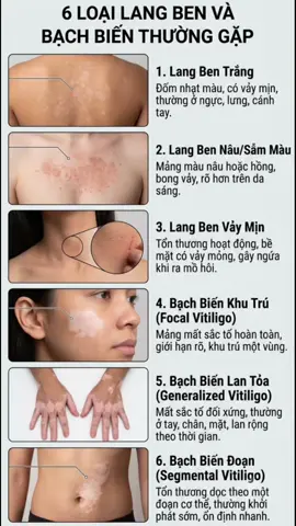 #langben #bachbien #trilangben #sactoda #dalieu 