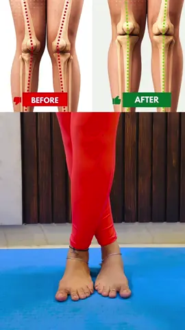 Every movment is a step closer to a stronger you. Share this with someone who really needs it.. each exercise to be done 20seconds*3  #heelpain #flatfoot #plantarfasciitis #knockknees #foothealth 