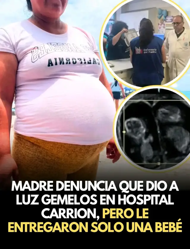 🚨🚨 ¡LO ÚLTIMO! MADRE DENUNCIA QUE DIO A LUZ A GEMELAS EN HOSPITAL CARRIÓN EN CALLAO, PERO EL DOCTOR SOLO LE ENTREGÓ UNA B3B3: ECOGRAFÍA CONFIRMABA QUE SU EMBARAZO ERA GEMELAR Una madre denunció una situación que ahora es materia de investigación en el Hospital Nacional Daniel Alcides Carrión, en el Callao. Según su testimonio, durante sus controles prenatales las ecografías indicaban que esperaba gemelas; sin embargo, tras dar a luz, afirma que solo recibió a una de las recién nacidas. La familia exige esclarecer qué ocurrió con la segunda b3b3 y por qué existirían diferencias entre los controles médicos y la información registrada durante el parto. Ante la denuncia, la Fiscalía dispuso diligencias, incluida la inmovilización y digitalización de la historia clínica, mientras que la Policía y la Defensoría del Pueblo también intervienen en el caso. Además, la Defensoría solicitó la participación de Susalud para revisar la atención brindada y los protocolos aplicados. Hasta el momento, no existe una conclusión oficial que confirme la desaparición de una segunda b3B3, por lo que las investigaciones deberán determinar qué ocurrió y si existen responsabilidades. #Callao #HospitalCarrión #Denuncia #Gemelas #Fiscalía 