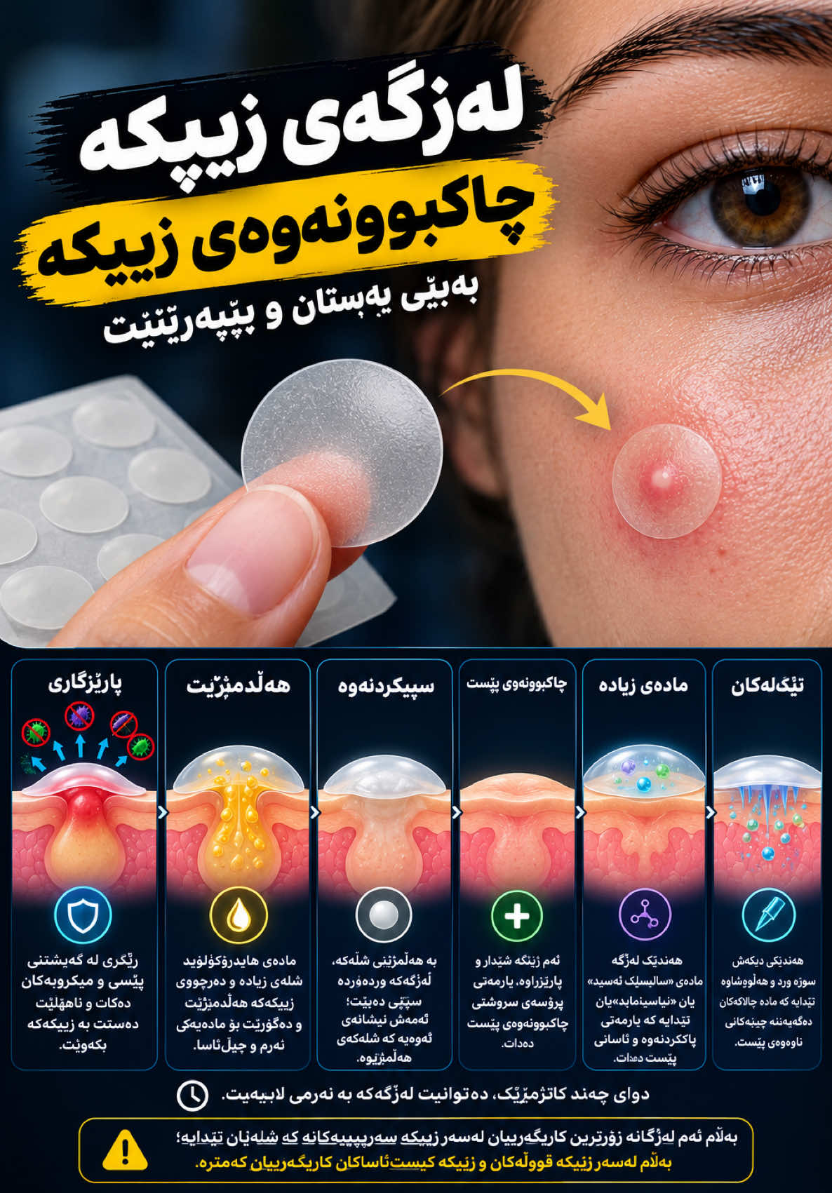 لەزگەیەکی بچووک دەتوانێت یارمەتیت بدات زیپکەکەت چاک ببێتەوە، بەبێ ئەوەی پەستانی پێوە بنێیت یان بیپەڕێنیت. ئەم جۆرە لەزگانە بە ناوی لەزگەی زیپکە ناسراون. زۆربەیان لە مادەیەک دروست کراون بە ناوی «هایدرۆکۆلۆید»؛ مادەیەک کە شلە هەڵدەمژێت و لە بنەڕەتدا بۆ ڕوپۆشکردنی برین بەکاردەهات. کاتێک لەزگەکە لەسەر زیپکەکە دادەنێیت، بەربەستێکی پارێزەر دروست دەکات کە ڕێگری لە گەیشتنی پیسی و میکرۆبەکان دەکات و ناهێڵێت دەستت بە زیپکەکە بکەوێت. لە ناو لەزگەکەدا، مادەی هایدرۆکۆلۆید شلەی زیادە و دەرچووی زیپکەکە هەڵدەمژێت و دەیگۆڕێت بۆ مادەیەکی نەرم و جێڵ‌ئاسا. بە هەڵمژینی شلەکە، لەزگەکە وردەوردە سپی دەبێت؛ ئەمەش نیشانەی ئەوەیە کە شلەکەی هەڵمژییوە. ئەم ژینگە شێدار و پارێزراوە یارمەتی پڕۆسەی سروشتی چاکبوونەوەی پێست دەدات. هەندێک لەزگە مادەی «سالیسلیک ئەسید»یان تێدایە کە یارمەتی پاککردنەوەی کونەکانی پێست دەدات، یان «نیاسیناماید»یان تێدایە کە دەتوانێت سووربوونەوە و ئاوسانی پێست کەم بکاتەوە. هەندێکی دیکەش نوکی تیژ و  وردیان تێدایە کە مادە چالاکەکان دەگەیەننە چینەکانی ناوەوەی پێست. دوای چەند کاتژمێرێک، دەتوانیت لەزگەکە بە نەرمی لاببەیت. بەڵام ئەم لەزگانە زۆرترین کاریگەرییان لەسەر زیپکە سەرپێییەکانە کە شلەیان تێدایە؛ بەڵام لەسەر زیپکە قووڵەکان و زیپکە شێوە کیسییەکان کاریگەرییان کەمترە. #زیپکە #جوانی_پێست #زانستی_پێست #lifelapskurdish #foryou 