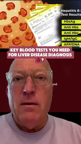 Discover essential blood tests for liver health, including GGT and Nash Fibrosure Plus. Understand symptoms and lifestyle changes to support your liver. Let's discuss strategies for a healthier liver! #liverhealth #nonalcoholicfattyliver #liverdisease #lifestylechange #healthyliving