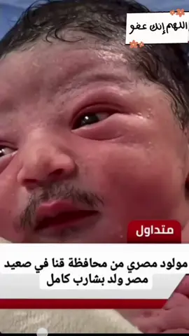 طفل👶 من قنا مولود بشنب سبحان الله ربي اغفر لي ورحمني