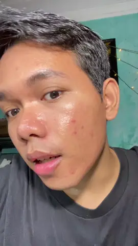Andalan gua di tahun ini tiap ada bekas jerawat pasti pake serum g2g yuja ini😔❤️ #serumdarkspot #serumviral #symwhite #foryou 